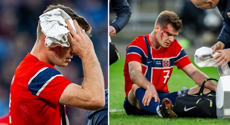 世体：瑟尔洛特头部受伤出战巴萨存疑，马竞周四评估球员情况