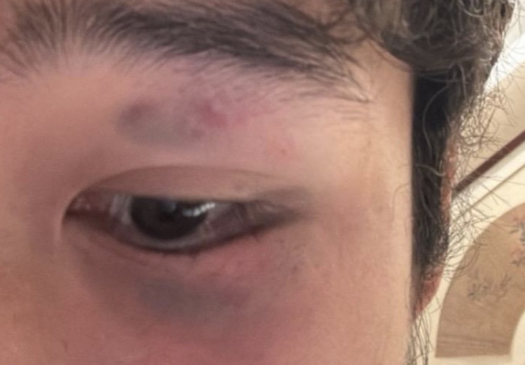 阮奇龙报平安：当时出现头晕呕吐，所以队医要求前往医院